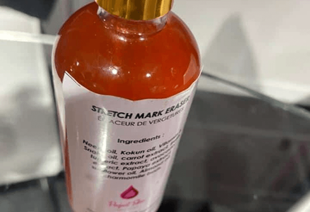 Stretch Mark Serum